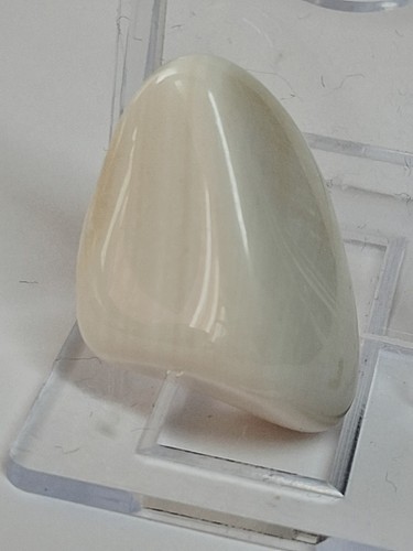 Muschelaragonit